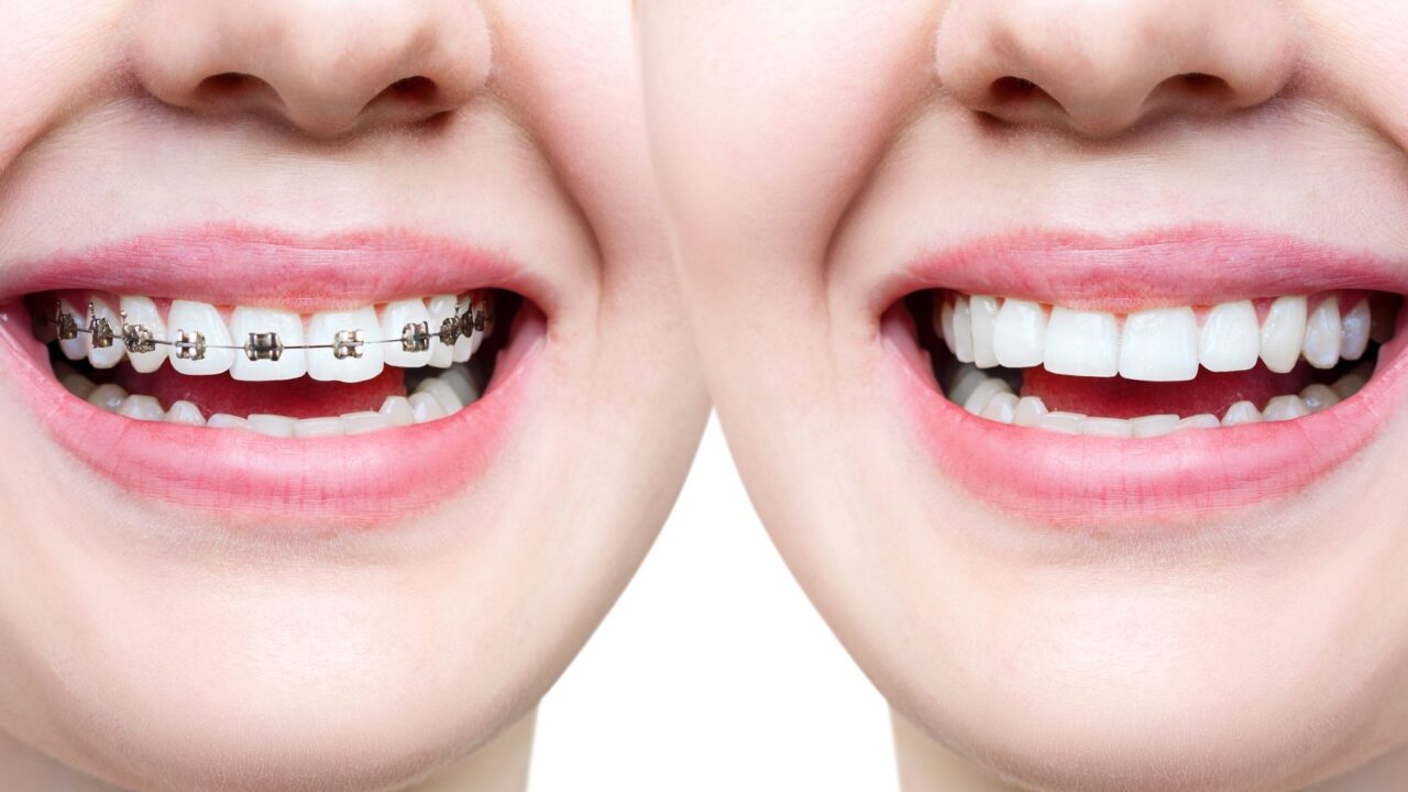 best invisalign dentist in Agoura Hills
