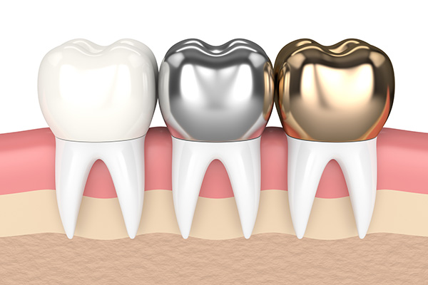 porcelain-dental-crowns